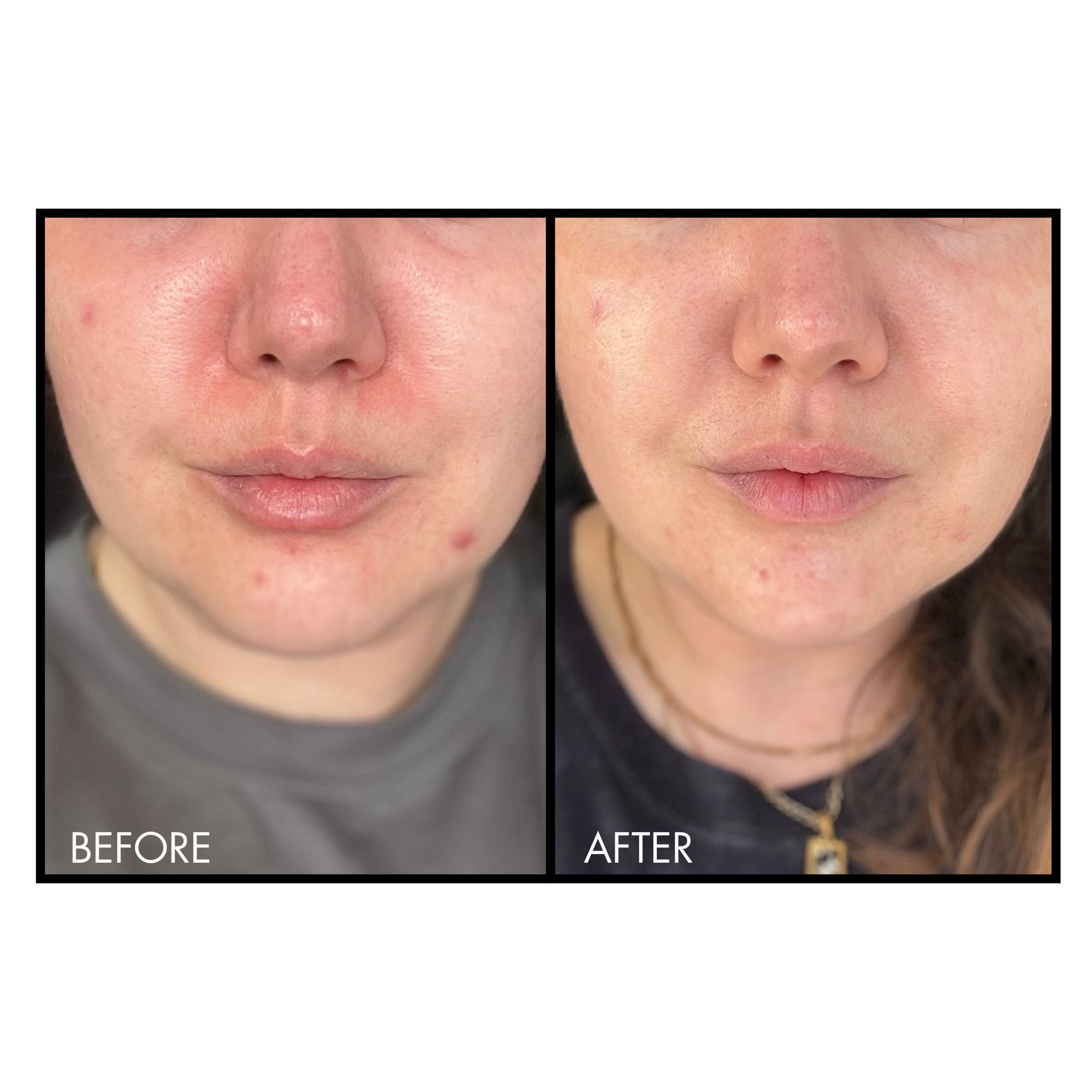 Before and after comparison of a person's face on a white background